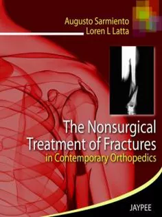 The Nonsurgical Treatment of Fractures in Contemporary Orthopedics