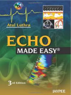 Echo Made Easy