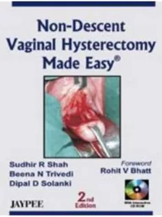 Non-Descent Vaginal Hysterectomy Made Easy