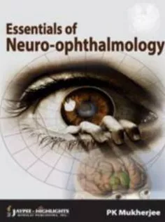 Essentials of Neuro Ophthalmology