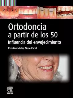 Ortodoncia A Partir De Los 50 Influencia Del Envejecimiento