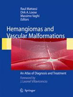 Vascular Malformations And Hemangiomas