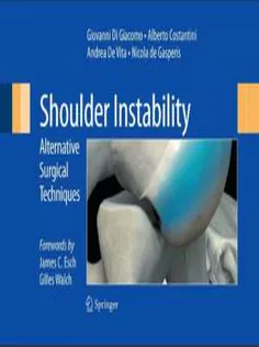Shoulder Instability: Alternative Surgical Techniques