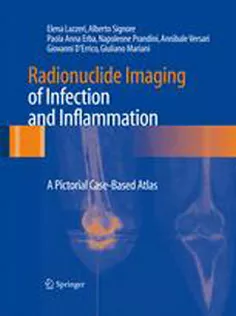 Radionuclide Imaging of Infection and Inflammation: A Pictorial Case-Based Atlas