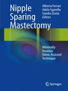 9788847053335 Nipple Sparing Mastectomy