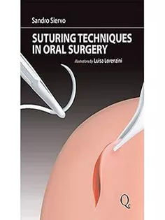 Suturing Techniques in Oral Surgery