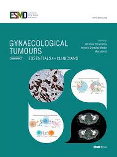 Gynaecological Tumours - Essentials for Clinicians