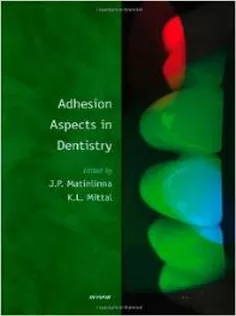 Adhesion Aspects in Dentistry