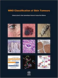 WHO Classification of Skin Tumours