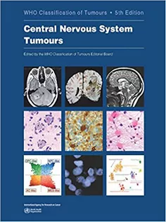 Central Nervous System Tumours: WHO Classification of Tumours