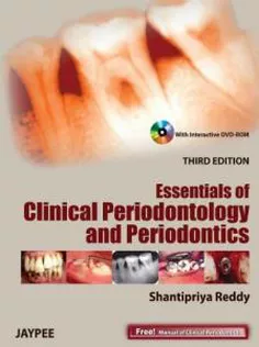 Essentials of Clinical Periodontology and Periodontics