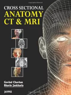 Cross Sectional Anatomy Ct & Mri