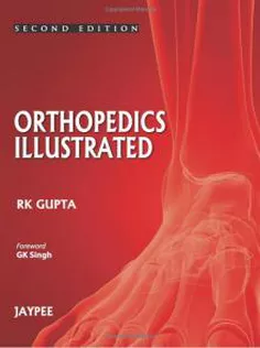 Orthopedics Illustrated