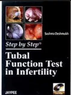 Step by Step Tubal Function Test In Infertility