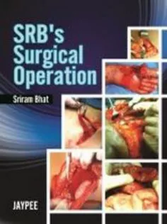 SRB's Surgical Operations