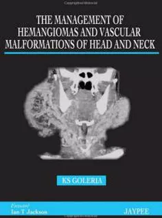 The Management of Hamangiomas and Vascular Malformations of Head and Neck