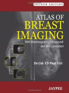 Atlas of Breast Imaging: With Mammography, Ultrasound and MRI Correlation
