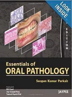 Essentials of Oral Pathology