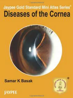 Diseases of the Cornea Jaypee Gold Standard Mini Atlas