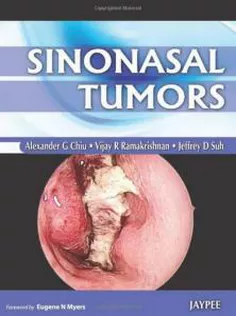 Sinonasal Tumors