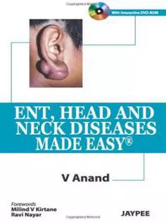 Ent, Head and Neck Diseases Made Easy