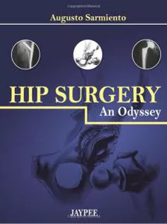 Hip Surgery An Odessy