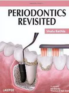 Periodontics Revisited