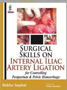 Surgical Skills on Internal Iliac Artery Ligation for Controlling Postpartum and Pelvic Hemorrhage