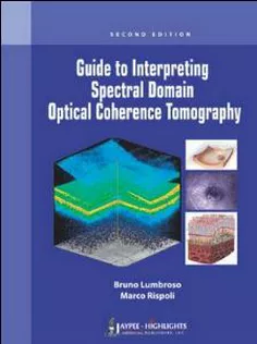 Guide to Interpreting Spectral Domain Optical Coherence Tomography