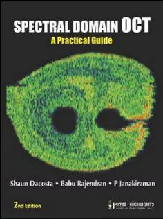 Spectral Domain OCT: A Practical Guide
