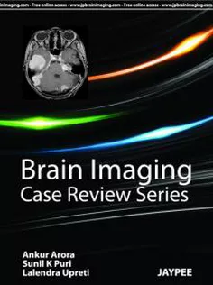 Brain Imaging: Case Review Series