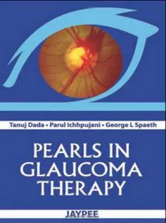 Pearls In Glaucoma Therapy