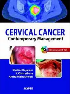 Cervical Cancer