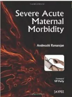 Severe Acute Maternal Morbidity