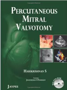 Percutaneous Mitral Valvotomy