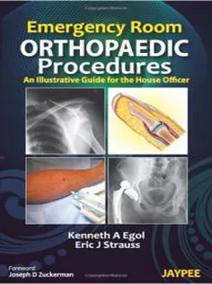 Emergency Room Orthopedic Procedures