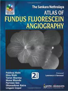 The Sankara Nethralaya Atlas of Fundus Fluorescein Angiography