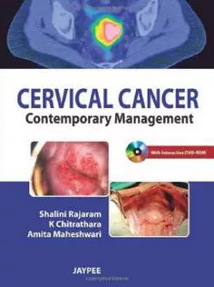 Cervical Cancer Contemporary Management
