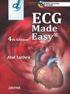 The ECG Made Easy