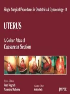 Uterus: A Colour Atlas of Caesarean Section