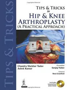 Tips And Tricks In Hip And Knee Arthroplasty
