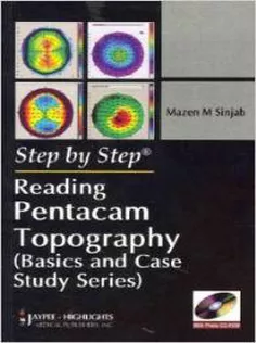 Reading Pentacam Topography