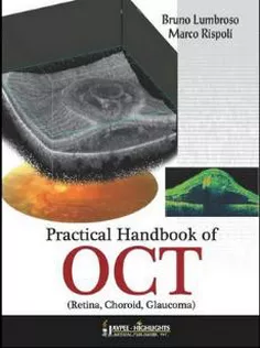 Practical Handbook Of Oct
