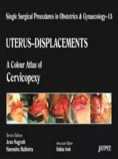 Uterus Displacements: A Colour Atlas of Cervicopexy