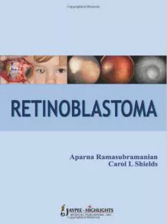 Retinoblastoma