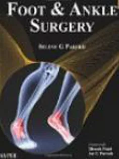 Foot and Ankle Surgery