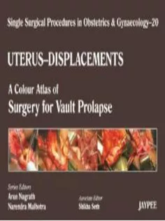 Uterus-Displacement: A Colour Atlas of Surgery for Vault Proplapse