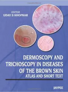 Dermoscopy and Trichoscopy in Diseases of the Brown Skin