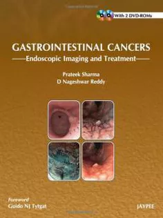 Gastrointestinal Cancers: Endoscopic Imaging and Treatment