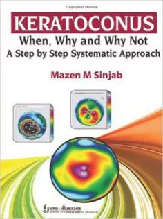 Keratoconus When, Why and Why Not: A Step-by-Step Systematic Approach